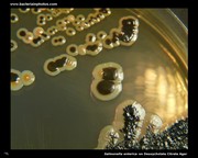 salmonella on deoxycholate citrate agar